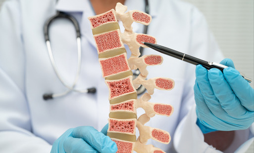 Bezpłatne badania w kierunku osteoporozy